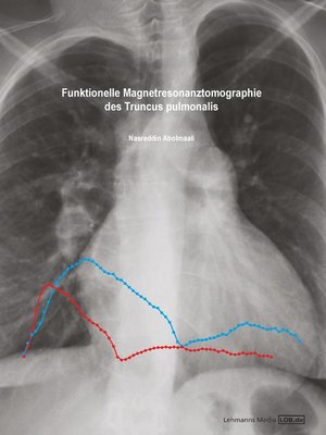 cover image of Funktionelle Magnetresonanztomographie des Truncus pulmonalis